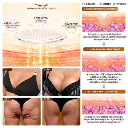 Trilumia®🏆 Mellvolumen, Emelés és Feszesítés Támogatására Szolgáló Nano Mikrotűs Tapasz Volufiline + Exosome + Rézpeptid Formula Sejtmegújító Technológiával Támogatva