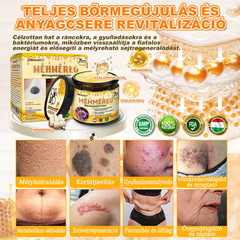 ✨✨ 🔥 Most 50% kedvezménnyel elérhető! ✨✨ DR.Fachmer® 🐝 Méhméreges Bőrmegújító Krém – Ráncok, Hegek, Pigmentfoltok, Striák, Akné, Ekcéma, Pikkelysömör Ellen
