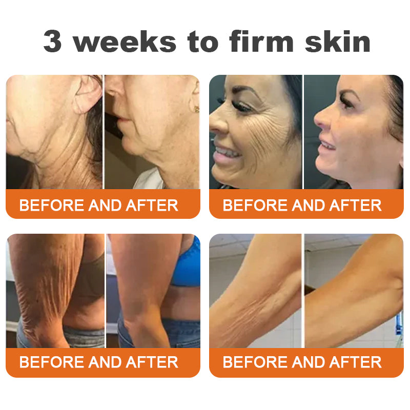 🌲 Az Egyesült Királyságban készült és onnan kerül kiszállításra 🇬🇧 Rolimey® Botox méhméreg feszesítő szérum stift (⏳ UTOLSÓ NAP – 70% KEDVEZMÉNY) ✨