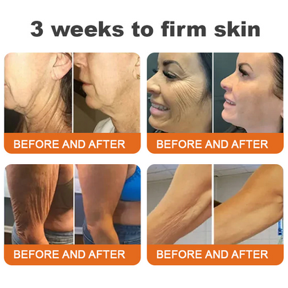 🌲 Az Egyesült Királyságban készült és onnan kerül kiszállításra 🇬🇧 Rolimey® Botox méhméreg feszesítő szérum stift (⏳ UTOLSÓ NAP – 70% KEDVEZMÉNY) ✨