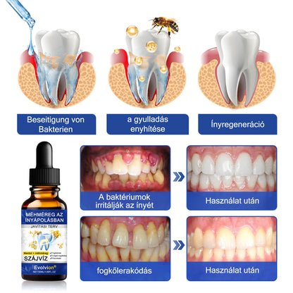 🦷𝐄𝐯𝐨𝐥𝐯𝐢𝐨𝐧® 𝐁𝐞𝐞𝐓𝐚𝐤𝐭 𝐙𝐚𝐡𝐧𝐟𝐥𝐞𝐢𝐬𝐜𝐡-𝐑𝐞𝐩𝐚𝐢𝐫 𝐋ö𝐬𝐮𝐧𝐠