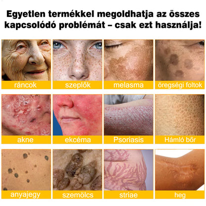 🐝💫 Rolimey® Méhméreg Pro Komplex Krém — Bőrfeszesítő ápolás minden bőrtípusra 🔥