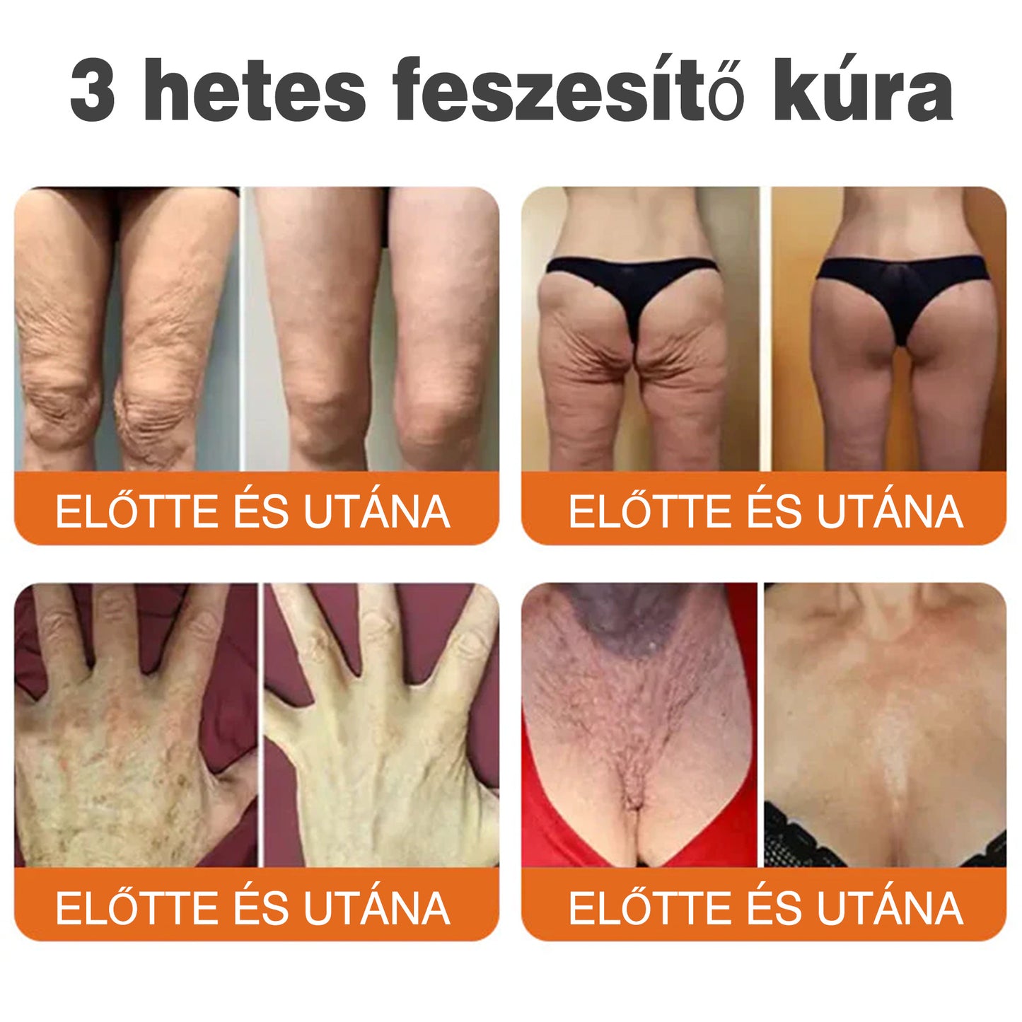 🐝💫 Rolimey® Méhméreg Pro Komplex Krém — Bőrfeszesítő ápolás minden bőrtípusra 🔥