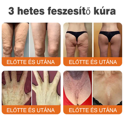 🐝💫 Rolimey® Méhméreg Pro Komplex Krém — Bőrfeszesítő ápolás minden bőrtípusra 🔥