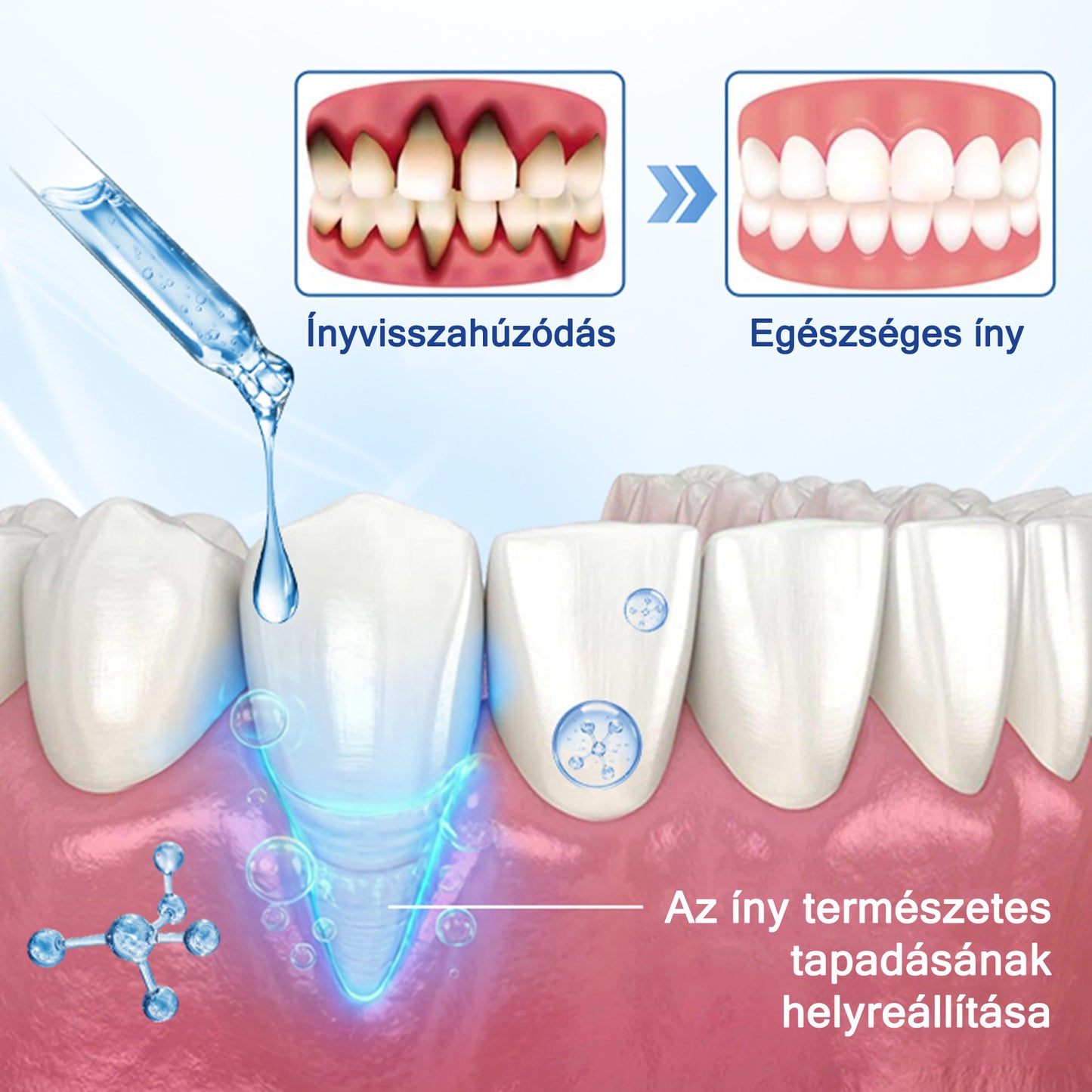 🦷𝐄𝐯𝐨𝐥𝐯𝐢𝐨𝐧® 𝐁𝐞𝐞𝐓𝐚𝐤𝐭 𝐙𝐚𝐡𝐧𝐟𝐥𝐞𝐢𝐬𝐜𝐡-𝐑𝐞𝐩𝐚𝐢𝐫 𝐋ö𝐬𝐮𝐧𝐠
