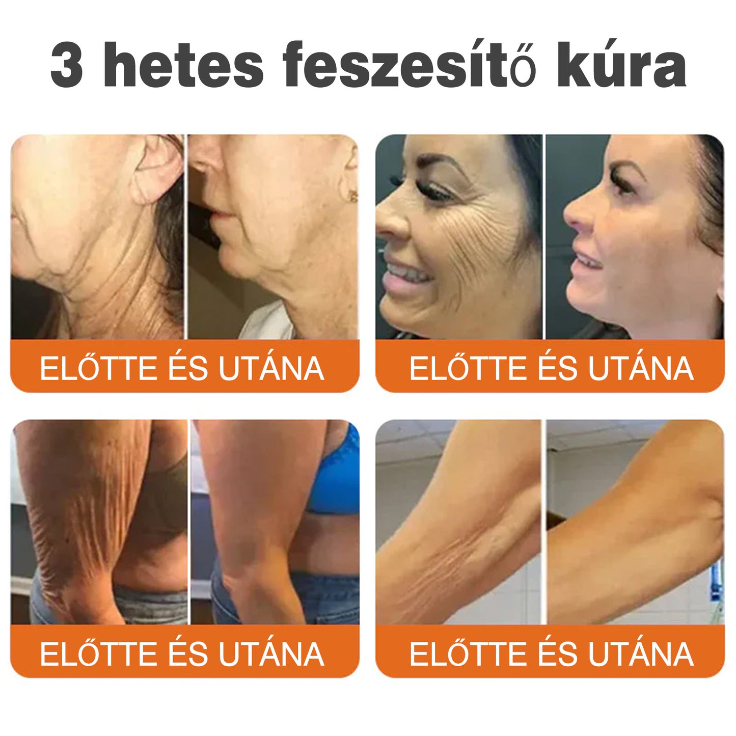 🐝💫 Rolimey® Méhméreg Pro Komplex Krém — Bőrfeszesítő ápolás minden bőrtípusra 🔥