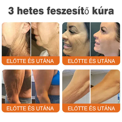 🐝💫 Rolimey® Méhméreg Pro Komplex Krém — Bőrfeszesítő ápolás minden bőrtípusra 🔥