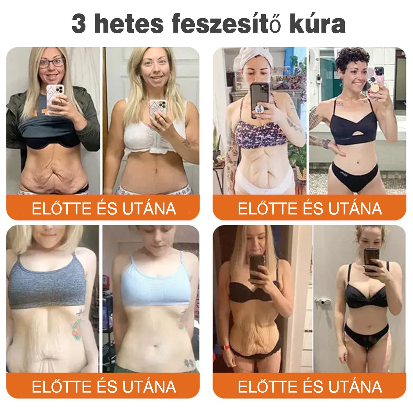 🐝💫 Rolimey® Méhméreg Pro Komplex Krém — Bőrfeszesítő ápolás minden bőrtípusra 🔥