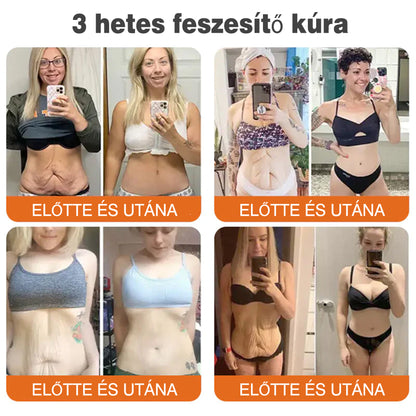 🐝💫 Rolimey® Méhméreg Pro Komplex Krém — Bőrfeszesítő ápolás minden bőrtípusra 🔥