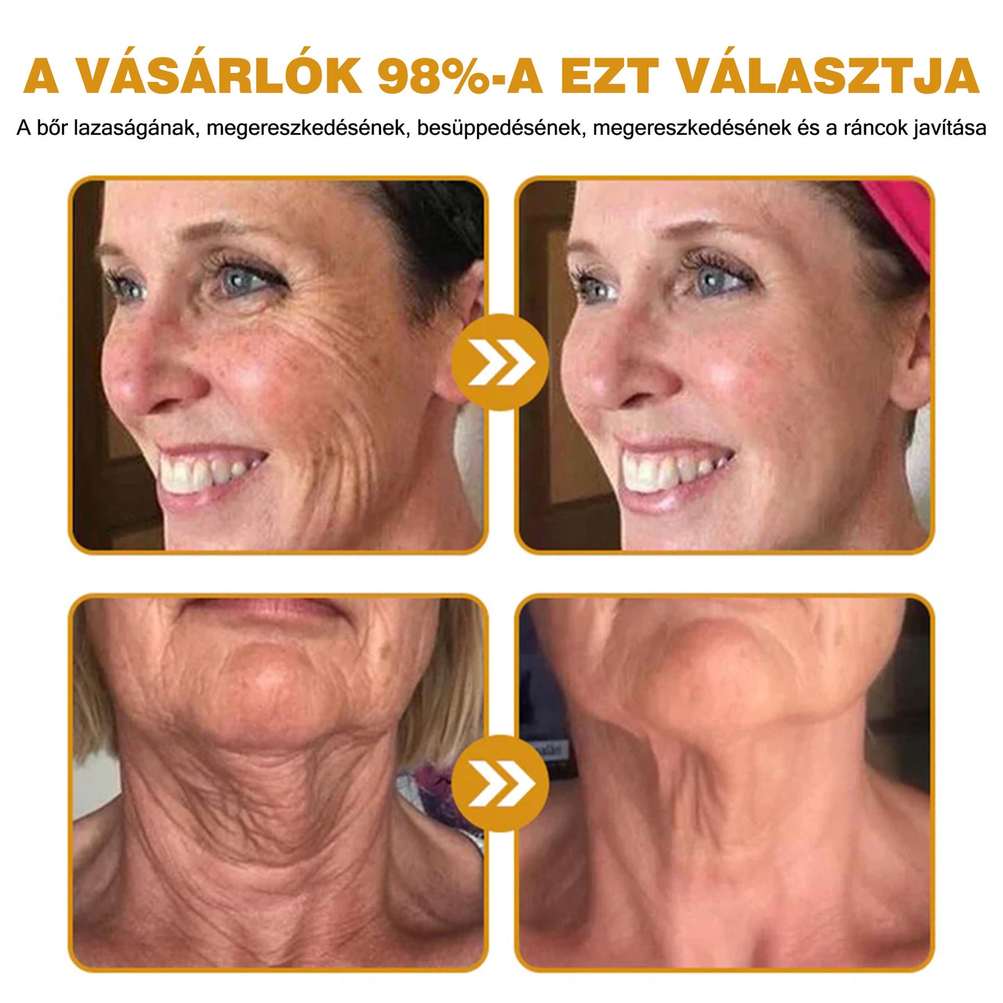 🐝💫 Rolimey® Méhméreg Pro Komplex Krém — Bőrfeszesítő ápolás minden bőrtípusra 🔥