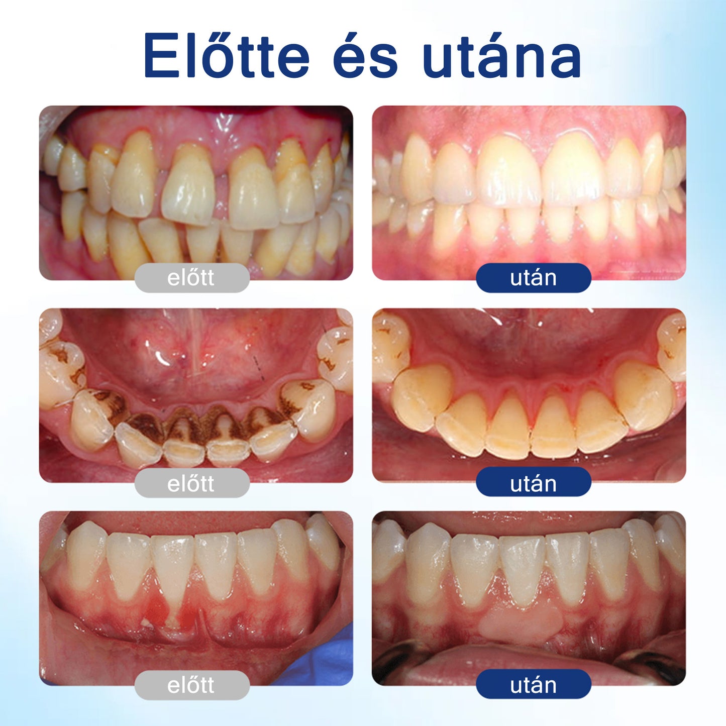 🦷𝐄𝐯𝐨𝐥𝐯𝐢𝐨𝐧® 𝐁𝐞𝐞𝐓𝐚𝐤𝐭 𝐙𝐚𝐡𝐧𝐟𝐥𝐞𝐢𝐬𝐜𝐡-𝐑𝐞𝐩𝐚𝐢𝐫 𝐋ö𝐬𝐮𝐧𝐠