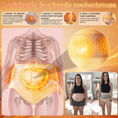 👨‍⚕️👨‍⚕️A márka hivatalos üzlete | 🍃GFOUK® 2026 Moringa és berberin 4 az 1-ben mikrorészecskés alakformáló és zsírégető rövidnadrág