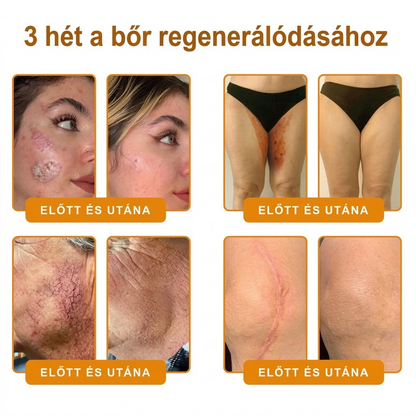 🥇Most 50% kedvezménnyel elérhető! ✨✨ DR.Fachmer® 🐝 Méhméreges Bőrmegújító Krém – Ráncok, Hegek, Pigmentfoltok, Striák, Akné, Ekcéma, Pikkelysömör Ellen (Copy) (Copy)