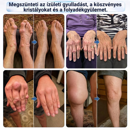 💥💥 DR.Fachmer® Mentol · Árnika · Ördögkarom 10 az 1-ben ízület- és izomápoló roll-on | Köszvény, ízületi merevség, duzzanat és izomfájdalom esetén | Gyorsan felszívódó, nem zsíros