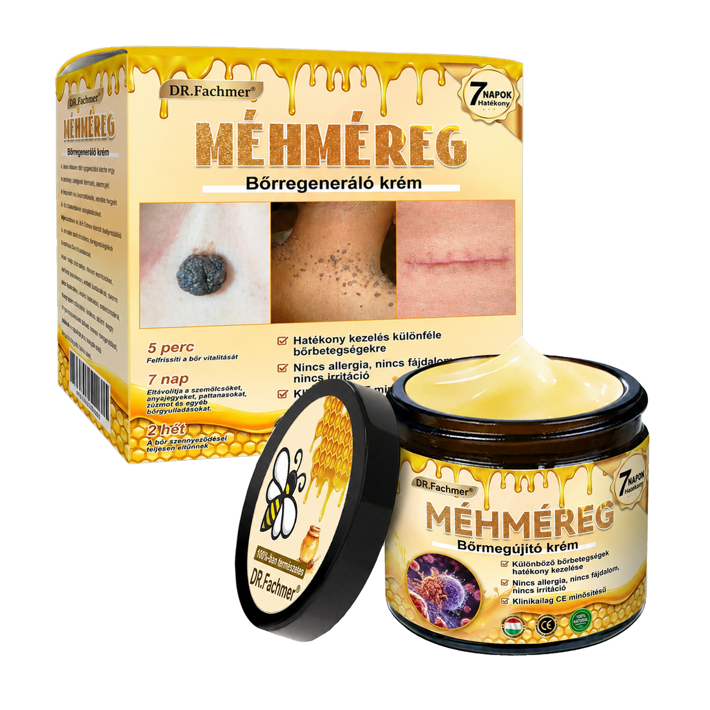 🥇Most 50% kedvezménnyel elérhető! ✨✨ DR.Fachmer® 🐝 Méhméreges Bőrmegújító Krém – Ráncok, Hegek, Pigmentfoltok, Striák, Akné, Ekcéma, Pikkelysömör Ellen (Copy) (Copy)
