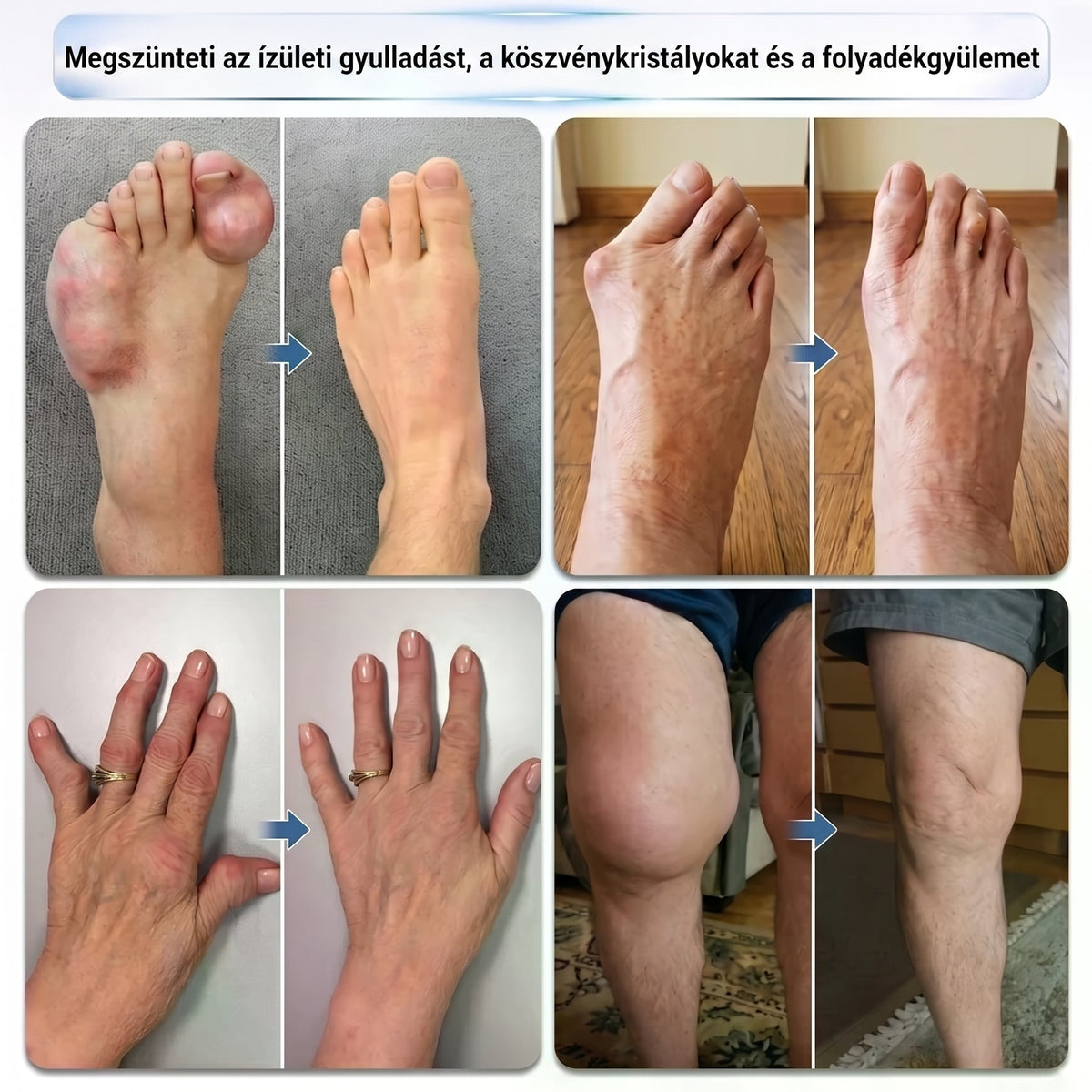 💥💥 DR.Fachmer® Mentol · Árnika · Ördögkarom 10 az 1-ben ízület- és izomápoló roll-on | Köszvény, ízületi merevség, duzzanat és izomfájdalom esetén | Gyorsan felszívódó, nem zsíros