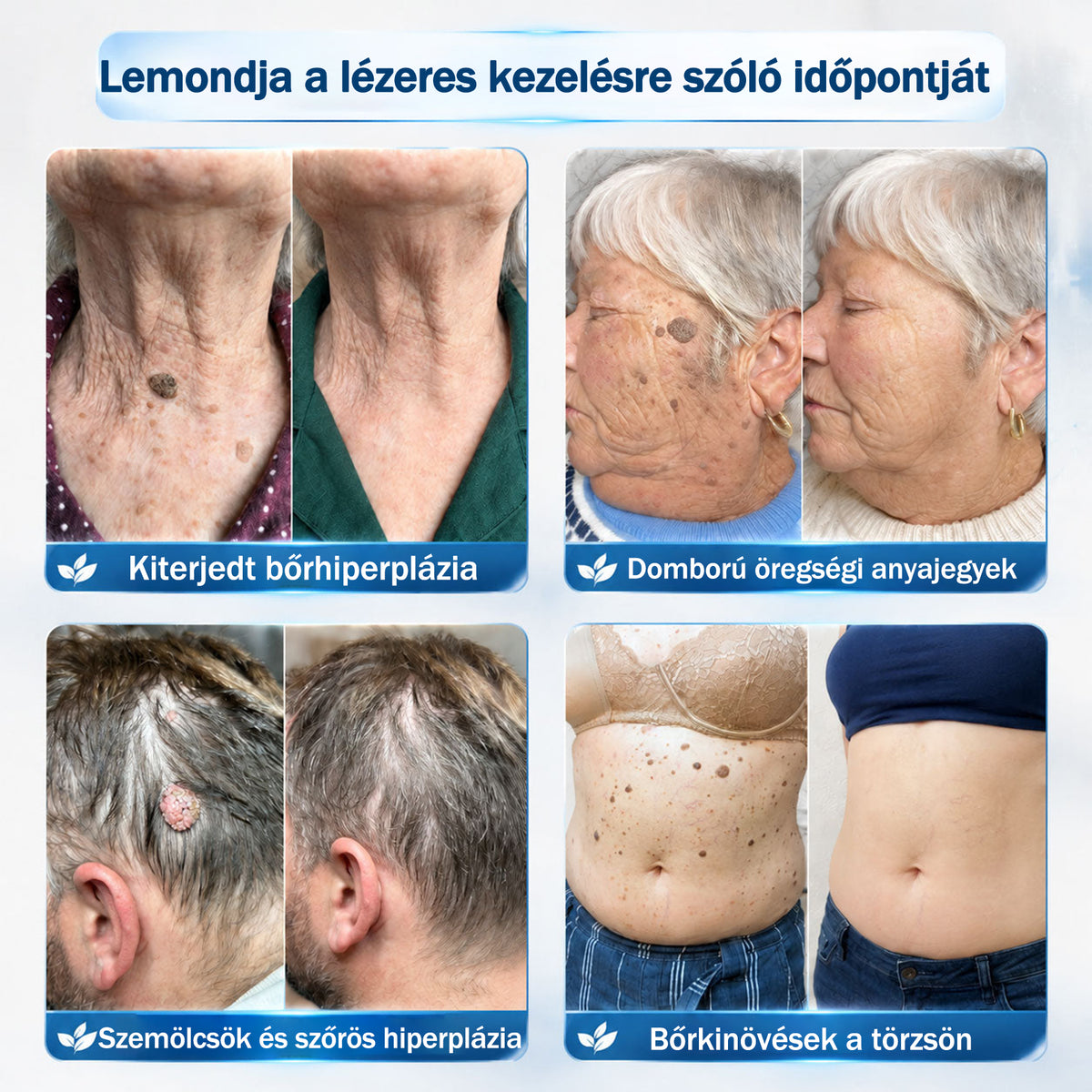 𝐇𝐢𝐯𝐚𝐭𝒂𝒍𝒐𝒔 𝒎á𝗿𝗸𝗮𝗯𝗼𝗹𝐭 | 🖊️ Rolimey® 𝟕 𝐧𝐚𝒑𝒐𝒔 𝒔𝒛𝗲𝗺ö𝗹𝗰𝘀- é𝐬 𝐟𝐨𝐥𝐭𝐞𝐥í𝐭ó (𝐟á𝐣𝐝𝐚𝐥𝒐𝒎𝒎𝒆𝒏𝒕𝒆𝒔, 𝒉𝒆𝗴 𝗻é𝗹𝗸ü𝐥𝐢 𝐠𝐨𝐥𝐲ó𝐬 𝐚𝐩𝐩𝐥𝐢𝐤á𝐭𝐨𝐫)🌴