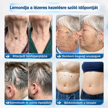 𝐇𝐢𝐯𝐚𝐭𝒂𝒍𝒐𝒔 𝒎á𝗿𝗸𝗮𝗯𝗼𝗹𝐭 | 🖊️ Rolimey® 𝟕 𝐧𝐚𝒑𝒐𝒔 𝒔𝒛𝗲𝗺ö𝗹𝗰𝘀- é𝐬 𝐟𝐨𝐥𝐭𝐞𝐥í𝐭ó (𝐟á𝐣𝐝𝐚𝐥𝒐𝒎𝒎𝒆𝒏𝒕𝒆𝒔, 𝒉𝒆𝗴 𝗻é𝗹𝗸ü𝐥𝐢 𝐠𝐨𝐥𝐲ó𝐬 𝐚𝐩𝐩𝐥𝐢𝐤á𝐭𝐨𝐫)🌴