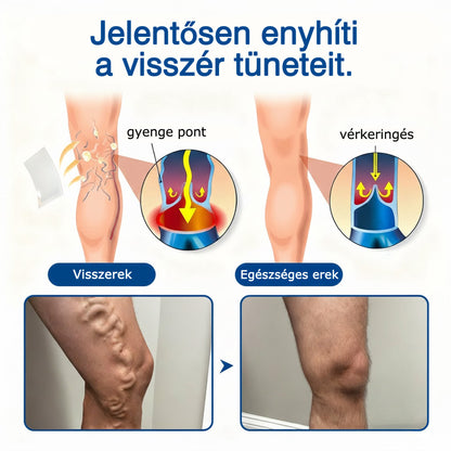 🌷🌷GFOUK® VeinEase mikrotűs ápoló tapasz⚡Azonnali enyhülés, hosszú távú eredmények