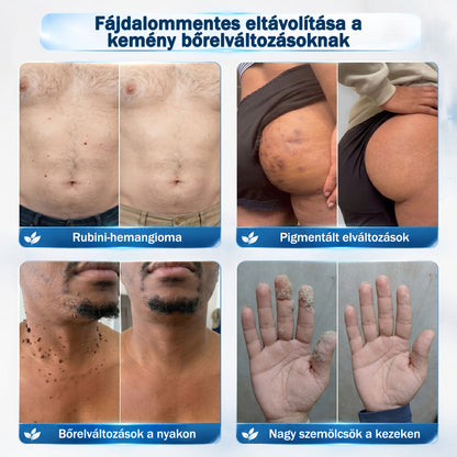𝐇𝐢𝐯𝐚𝐭𝒂𝒍𝒐𝒔 𝒎á𝗿𝗸𝗮𝗯𝗼𝗹𝐭 | 🖊️ Rolimey® 𝟕 𝐧𝐚𝒑𝒐𝒔 𝒔𝒛𝗲𝗺ö𝗹𝗰𝘀- é𝐬 𝐟𝐨𝐥𝐭𝐞𝐥í𝐭ó (𝐟á𝐣𝐝𝐚𝐥𝒐𝒎𝒎𝒆𝒏𝒕𝒆𝒔, 𝒉𝒆𝗴 𝗻é𝗹𝗸ü𝐥𝐢 𝐠𝐨𝐥𝐲ó𝐬 𝐚𝐩𝐩𝐥𝐢𝐤á𝐭𝐨𝐫)🌴