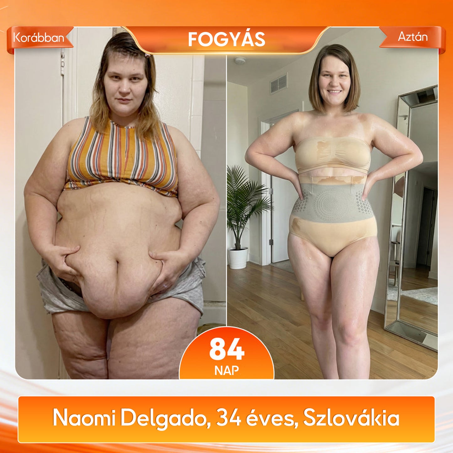 👨‍⚕️👨‍⚕️A márka hivatalos üzlete | 🍃GFOUK® 2026 Moringa és berberin 4 az 1-ben mikrorészecskés alakformáló és zsírégető rövidnadrág