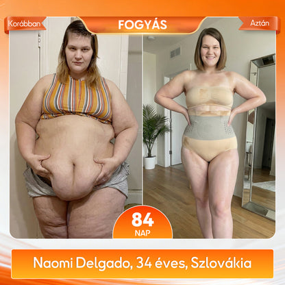 👨‍⚕️👨‍⚕️A márka hivatalos üzlete | 🍃GFOUK® 2026 Moringa és berberin 4 az 1-ben mikrorészecskés alakformáló és zsírégető rövidnadrág