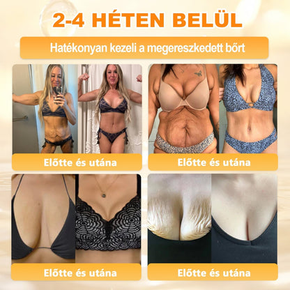 ✨✨ 🔥 Most 50% kedvezménnyel elérhető! ✨✨ DR.Fachmer® 🐝 Méhméreges Bőrmegújító Krém – Ráncok, Hegek, Pigmentfoltok, Striák, Akné, Ekcéma, Pikkelysömör Ellen