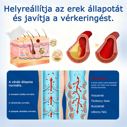 🌷🌷GFOUK® VeinEase mikrotűs ápoló tapasz⚡Azonnali enyhülés, hosszú távú eredmények