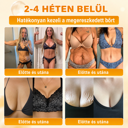🥇Most 50% kedvezménnyel elérhető! ✨✨ DR.Fachmer® 🐝 Méhméreges Bőrmegújító Krém – Ráncok, Hegek, Pigmentfoltok, Striák, Akné, Ekcéma, Pikkelysömör Ellen (Copy) (Copy)