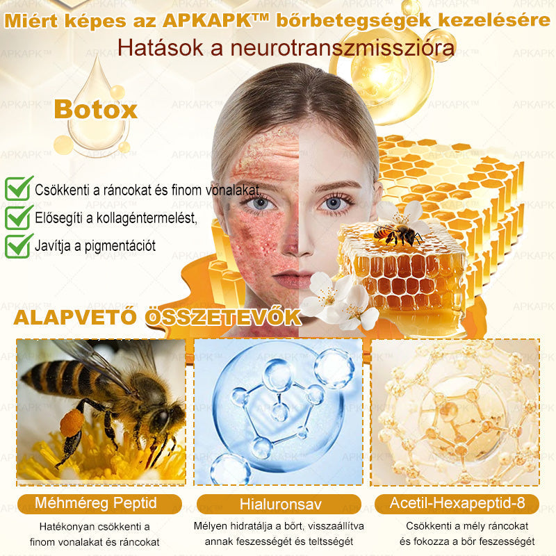 ✨✨ 🔥 Most 50% kedvezménnyel elérhető! ✨✨ DR.Fachmer® 🐝 Méhméreges Bőrmegújító Krém – Ráncok, Hegek, Pigmentfoltok, Striák, Akné, Ekcéma, Pikkelysömör Ellen