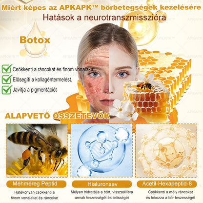 ✨✨ 🔥 Most 50% kedvezménnyel elérhető! ✨✨ DR.Fachmer® 🐝 Méhméreges Bőrmegújító Krém – Ráncok, Hegek, Pigmentfoltok, Striák, Akné, Ekcéma, Pikkelysömör Ellen