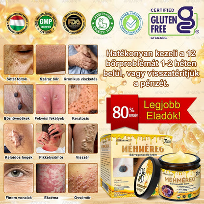 ✨✨ 🔥 Most 50% kedvezménnyel elérhető! ✨✨ DR.Fachmer® 🐝 Méhméreges Bőrmegújító Krém – Ráncok, Hegek, Pigmentfoltok, Striák, Akné, Ekcéma, Pikkelysömör Ellen