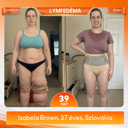 👨‍⚕️👨‍⚕️A márka hivatalos üzlete | 🍃GFOUK® 2026 Moringa és berberin 4 az 1-ben mikrorészecskés alakformáló és zsírégető rövidnadrág