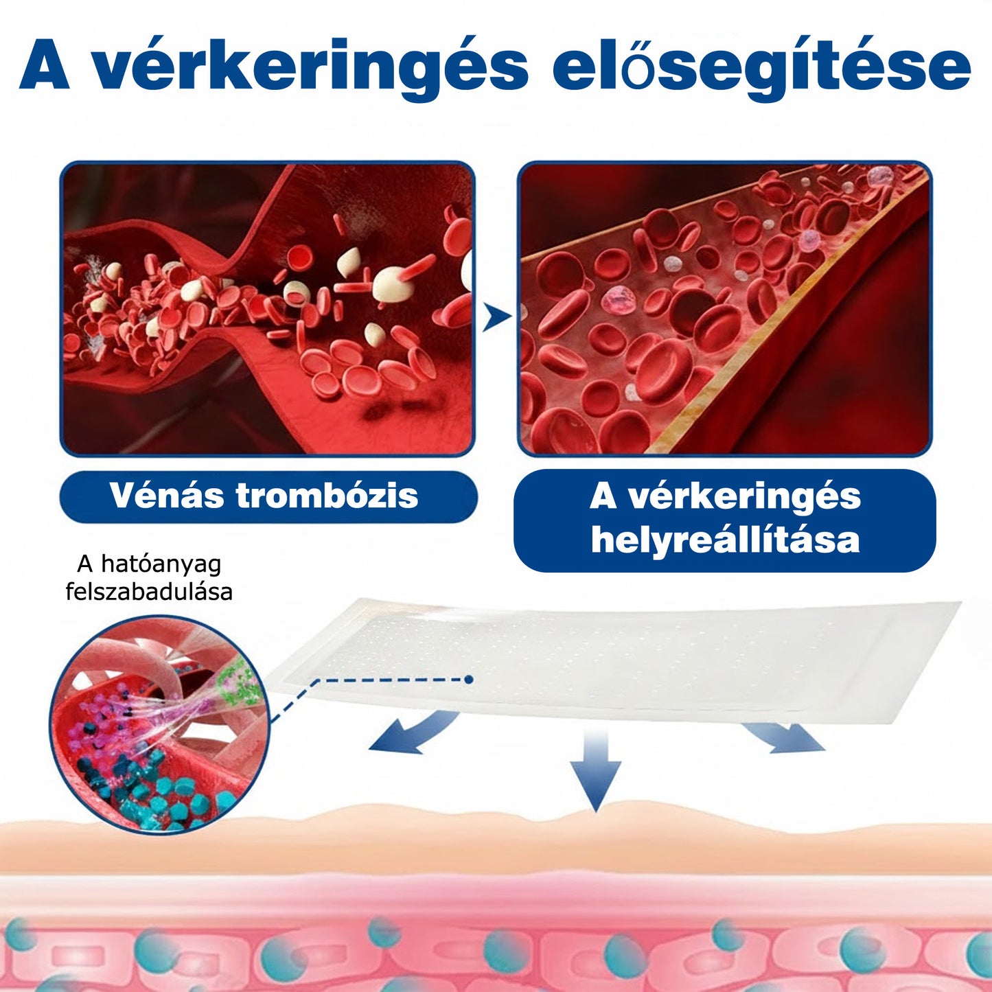 🌷🌷GFOUK® VeinEase mikrotűs ápoló tapasz⚡Azonnali enyhülés, hosszú távú eredmények