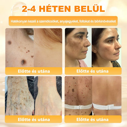 ✨✨ 🔥 Most 50% kedvezménnyel elérhető! ✨✨ DR.Fachmer® 🐝 Méhméreges Bőrmegújító Krém – Ráncok, Hegek, Pigmentfoltok, Striák, Akné, Ekcéma, Pikkelysömör Ellen