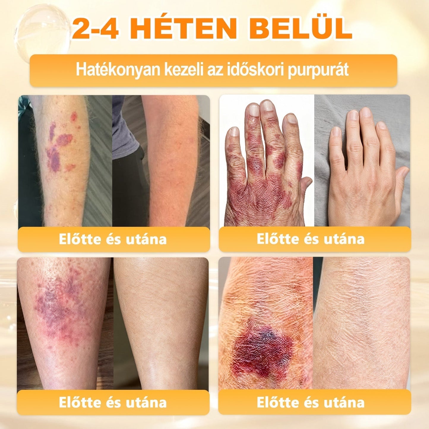 ✨✨ 🔥 Most 50% kedvezménnyel elérhető! ✨✨ DR.Fachmer® 🐝 Méhméreges Bőrmegújító Krém – Ráncok, Hegek, Pigmentfoltok, Striák, Akné, Ekcéma, Pikkelysömör Ellen
