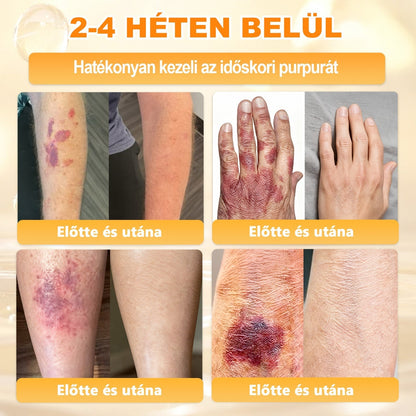 ✨✨ 🔥 Most 50% kedvezménnyel elérhető! ✨✨ DR.Fachmer® 🐝 Méhméreges Bőrmegújító Krém – Ráncok, Hegek, Pigmentfoltok, Striák, Akné, Ekcéma, Pikkelysömör Ellen