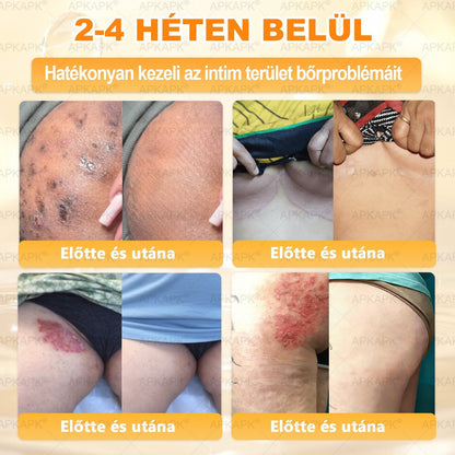 ✨✨ 🔥 Most 50% kedvezménnyel elérhető! ✨✨ DR.Fachmer® 🐝 Méhméreges Bőrmegújító Krém – Ráncok, Hegek, Pigmentfoltok, Striák, Akné, Ekcéma, Pikkelysömör Ellen