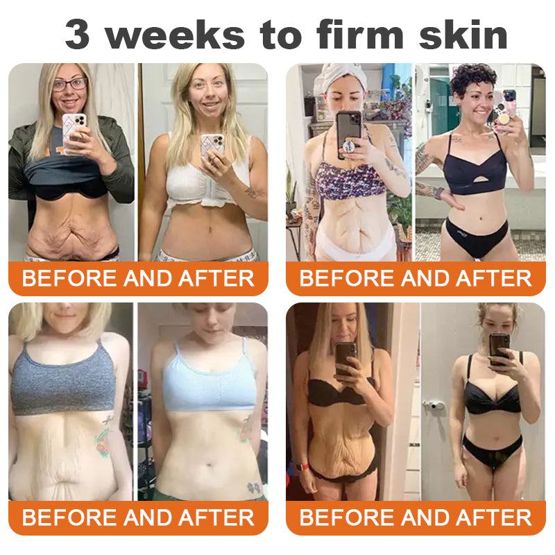 🌲 Az Egyesült Királyságban készült és onnan kerül kiszállításra 🇬🇧 Rolimey® Botox méhméreg feszesítő szérum stift (⏳ UTOLSÓ NAP – 70% KEDVEZMÉNY) ✨