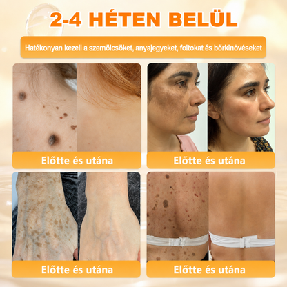 🥇Most 50% kedvezménnyel elérhető! ✨✨ DR.Fachmer® 🐝 Méhméreges Bőrmegújító Krém – Ráncok, Hegek, Pigmentfoltok, Striák, Akné, Ekcéma, Pikkelysömör Ellen (Copy) (Copy)