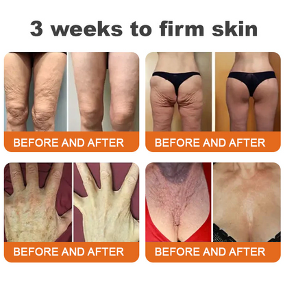 🌲 Az Egyesült Királyságban készült és onnan kerül kiszállításra 🇬🇧 Rolimey® Botox méhméreg feszesítő szérum stift (⏳ UTOLSÓ NAP – 70% KEDVEZMÉNY) ✨
